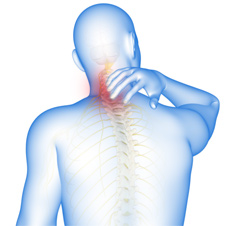 Cervical Spondylosis