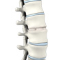 Anterior Lumbar Interbody Fusion