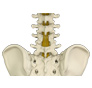 Lumbar Laminectomy