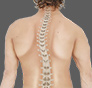 Scoliosis correction / Scoliosis Derotation / Scoliosis Fusion