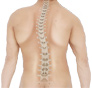 Spinal Deformity