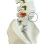 Spondylolisthesis