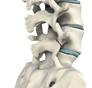 Spondylolysis